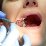 Root Canal Treatment: Common Myths Debunked